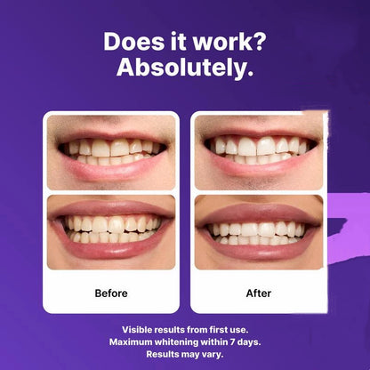 Purple Teeth Whitening Serum